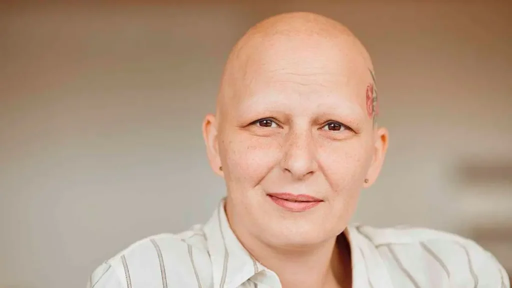 kein haarausfall bei chemo schlechtes zeichen